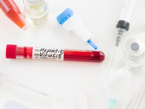 Close-up shot of a blood test for hepatitis C