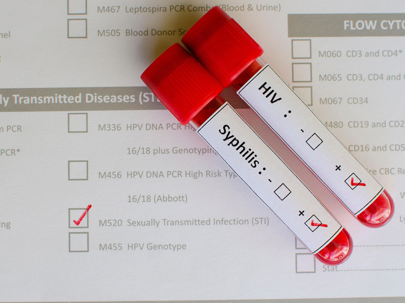 Phials of blood to illustrate blood tests for STDs