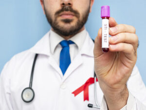 Male doctor holding a phial of blood, testing for STI