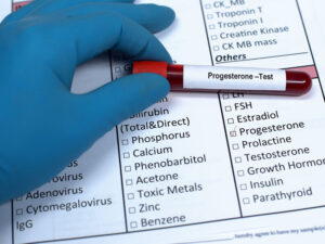 Phial of blood to test for progesterone hormone imbalance