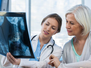 doctor showing x-ray to patient to explain impact of osteoporosis