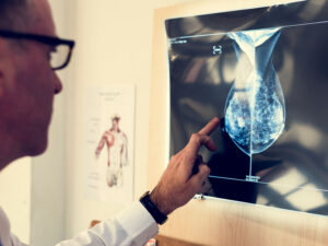 doctor checking x-ray for signs of breast cancer