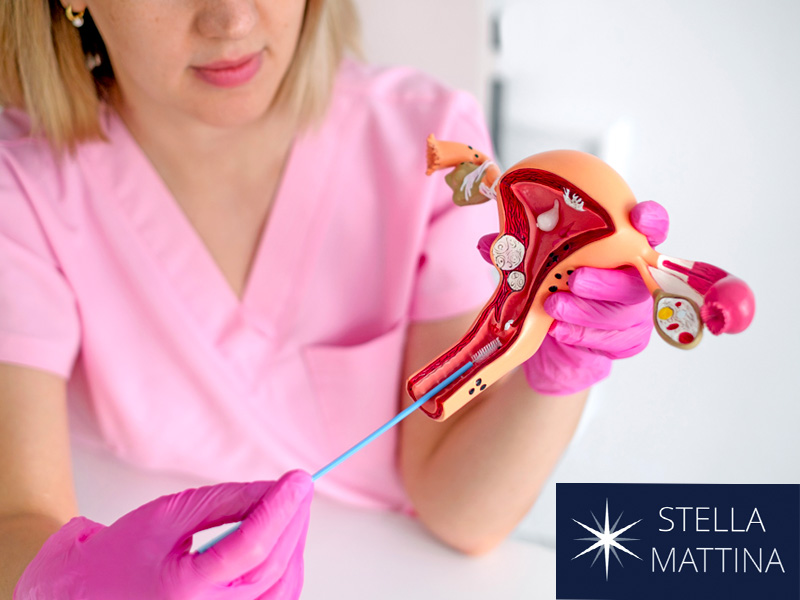 gynecologist holding model of uterus to illustrate preventing cervical cancer