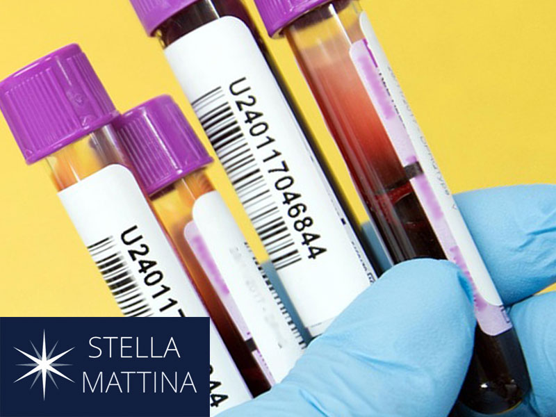 Gloved hand holding several blood sample phials to illustrate having in-house labs for rapid test results
