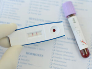 HIV test result with phial of blood to illustrate HIV testing during pregnancy