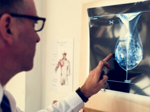 doctor checking xray of breast to illustrate screening tests for breast cancer